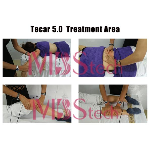 Back Pain Tecar Therapy Machine