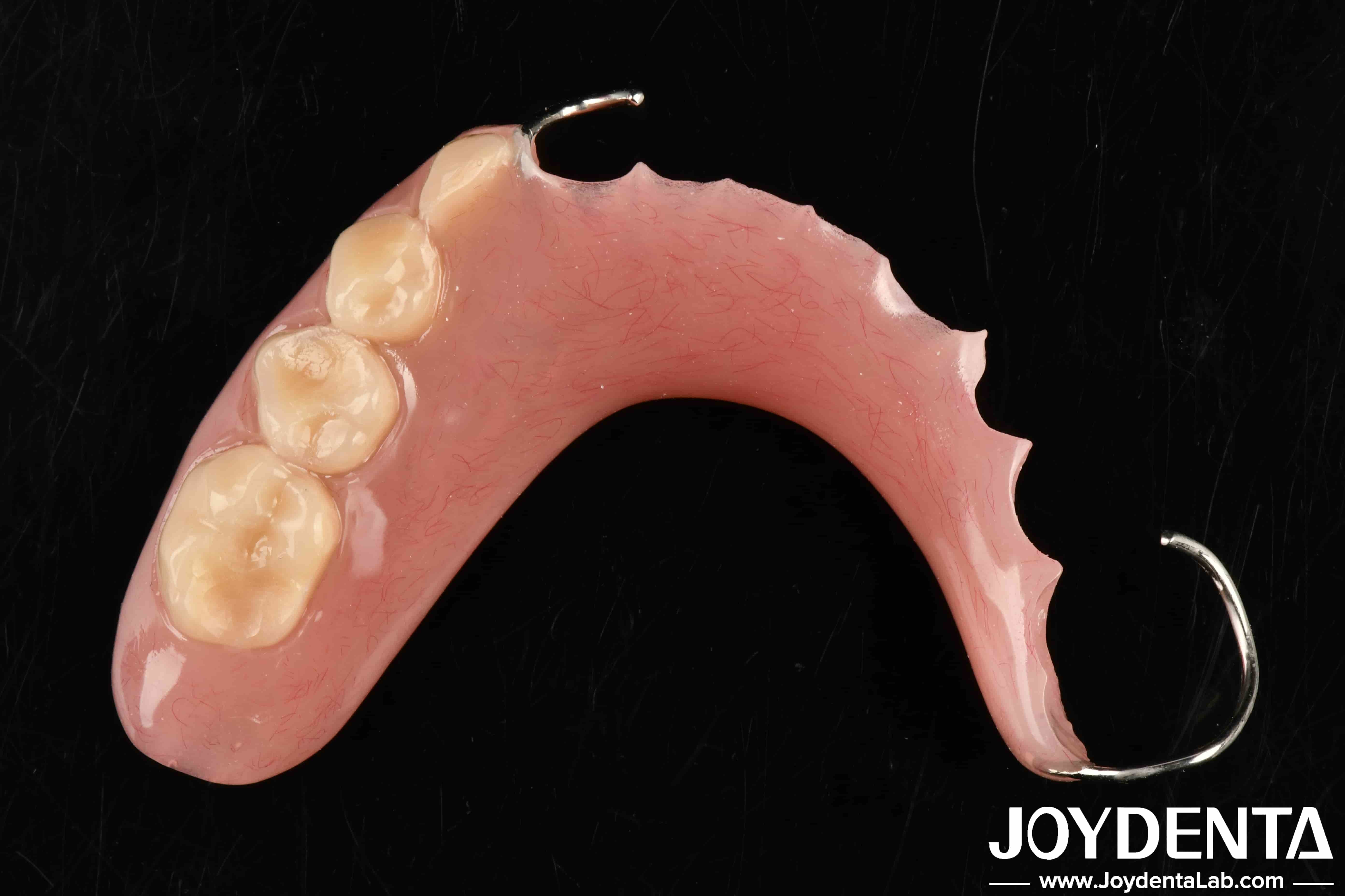  Elaborate Technology For Stable Oral Structure Framework Set Up Teeth Finish In Dental Application Manufactures