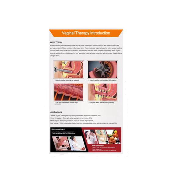 Iso Rf Micro Acne Scars Co2 Fractional Laser Machine
