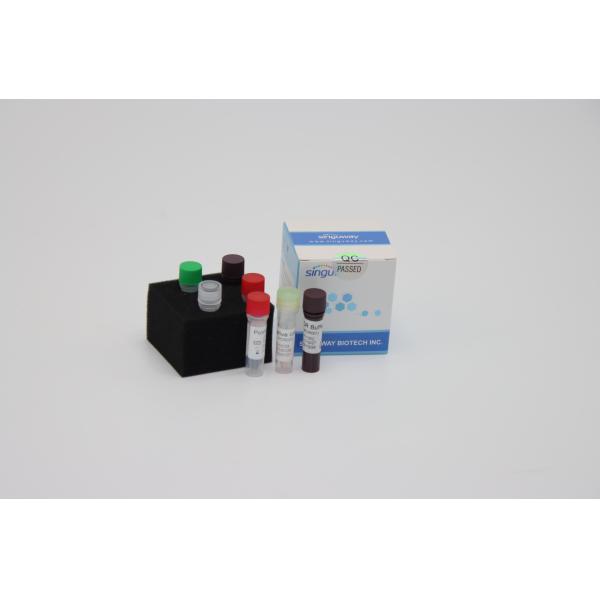 Laboratory Multiplex Fast Real Time RT PCR Detection Kit Reagents For Sars Virus