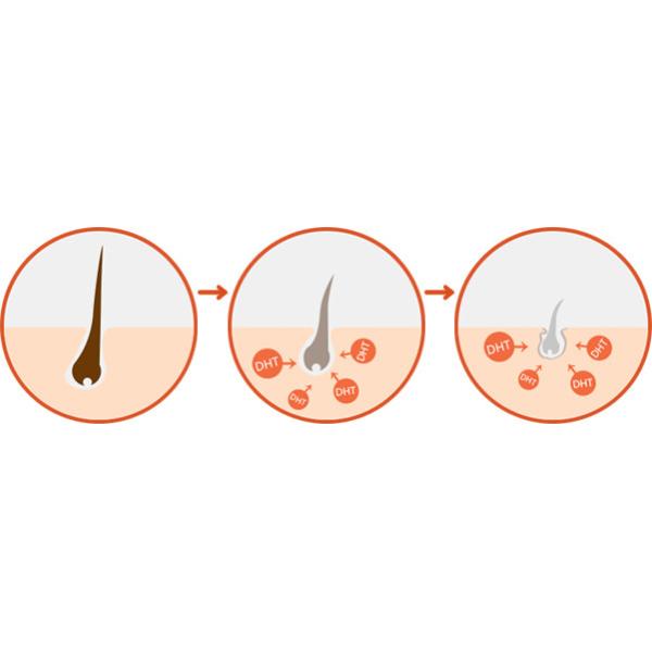 Low Level Laser Therapy For Hair Growth
