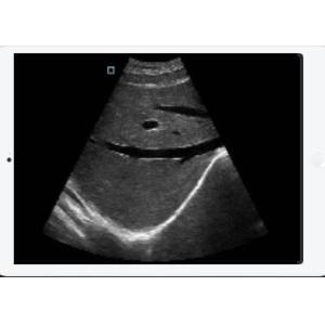 Custom USB Wifi Connection Handheld Baby Doppler With Changable Transducers