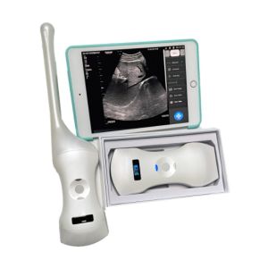 3 in 1 Wireless Convex Phased Array Linear Transvaginal Array  Color Doppler Ultrasound Scanner