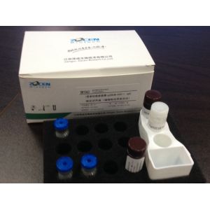 NGAL H-ALB RBP Cys-C β2-MG Kidney Function Test Kit For Chemiluminescence