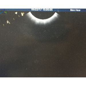 Logiq i GE 8C-RS Ultrasound Transducer Probe Micro Convex Array Pediatric