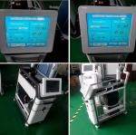 Beijing SANHE Q-switch nd yag laser for different colors tattoo removal and skin