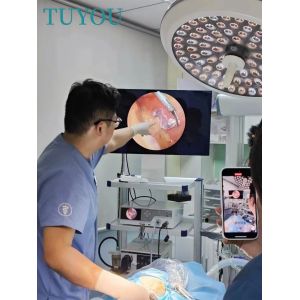 4K 60FPS Endoscope Camera System with LED Light Source and SDI Input Interface