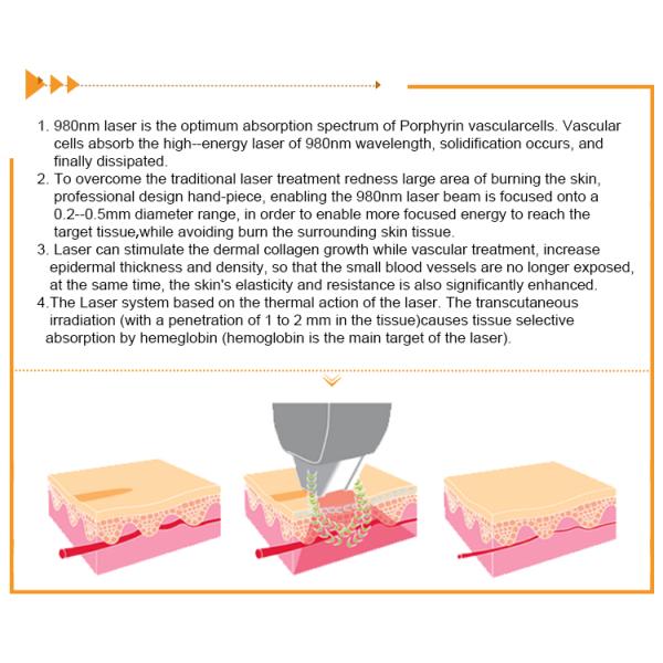 980nm Portable CE Thread Vein Removal Machine