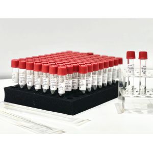 One Step Sample Release Reagent PCR Extraction Kit From Patient Pharynx Swab