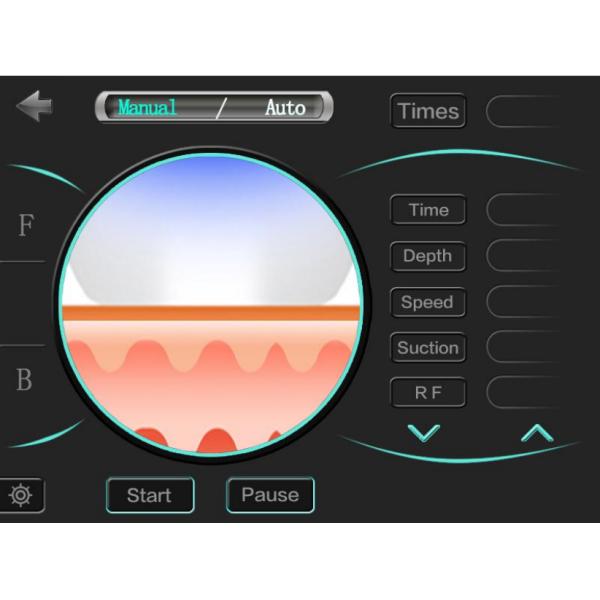 Skin Tightening RF Microneedling Machine
