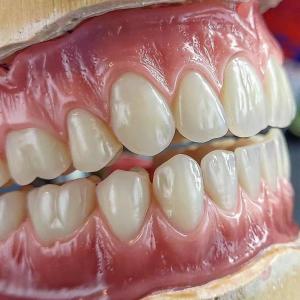 China Precise Temporary Full Acrylic Denture Teeth Ivoclar ISO Aprroved on sale