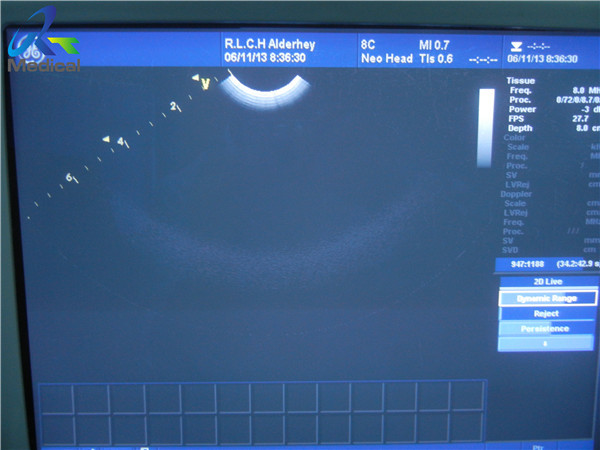 Quality GE 8C Convex Array Used Ultrasound Probe 11.5 MHz For Scanning Machine for sale