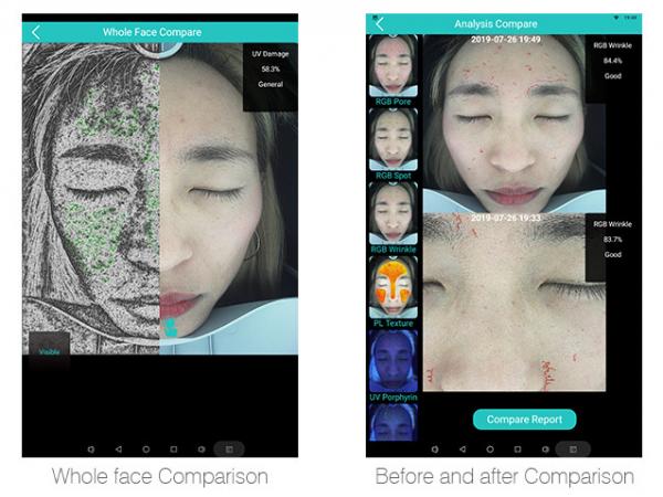 Humanized Design 3d Home Analyzers For Facial Skin 12 Skin Problem Detected