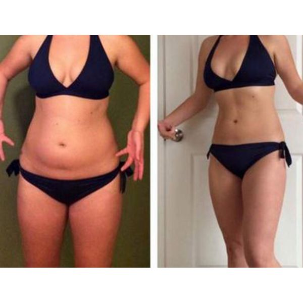 Deep Lymphatic Detox Weight Loss Pressotherapy Machine